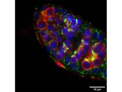 Bhupendra Shravage Research Image5