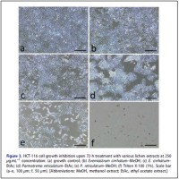 Cell Growth Inhibition
