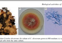 Biological Activities of Lichen Cetrelia